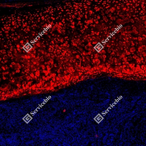 3 GB15373 _Aggrecan_red_D01636_D0163625081401 d800 H trachea_5.0x_IF_WM.jpg