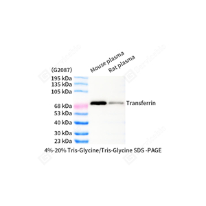 01WB2 GB111312 20251120_Transferrin_d500_WB - 副本.jpg