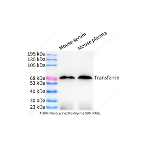 01WB2 GB150148 20251117_SD_Transferrin_d1000_WB.jpg