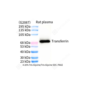01WB3 GB150148 20251118_SD_Transferrin_d1000_WB.jpg