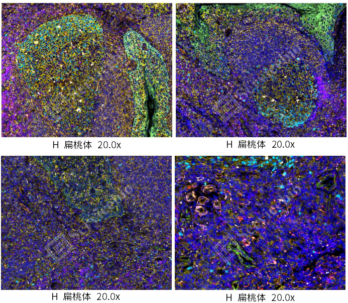9标10色扁桃体 - 副本.jpg