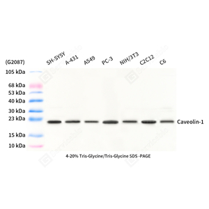 01WB1 GB15409 20251113_M_Caveolin 1_mAb45425092404_d1000_WB-1.jpg