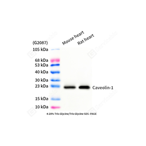 01WB2 GB15409 20251113_M_Caveolin 1_mAb45425092404_d1000_WB-2.jpg