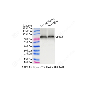 01WB1 GB150066_CPT1A_CPT1A_d1000_WB.jpg