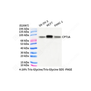 01WB2 GB150066 GB150066_CPT1A_d1000_WB.jpg