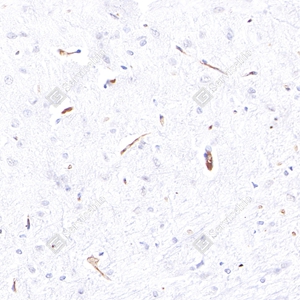 2 GB12086_eNOS_4F2H6 d1000 R brain_40.0x_IHC_WM.jpg