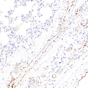 4 GB12086_eNOS_4F2H6 d1000 R lung_35.0x_IHC_WM.jpg