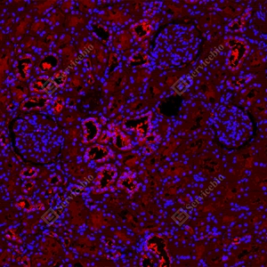 13 GB15847_Keap1_red_D01820_D0182025091601 d100 H kidney_15.0x_IF_WM.jpg