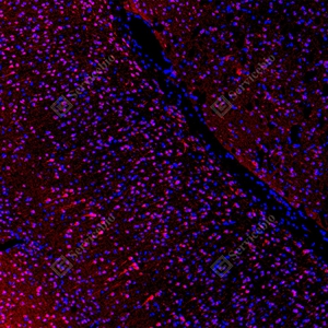 14 GB15847_Keap1_red_D01820_D0182025091601 d100 M brain_10.0x_IF_WM.jpg