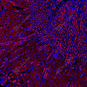 15 GB15847_Keap1_red_D01820_D0182025091601 d100 M kidney_10.0x_IF_WM.jpg