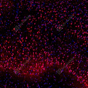 16 GB15847_Keap1_red_D01820_D0182025091601 d100 R brain_10.0x_IF_WM.jpg