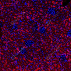 17 GB15847_Keap1_red_D01820_D0182025091601 d100 R kidney_10.0x_IF_WM.jpg