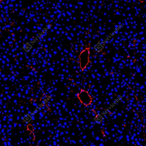 15 GB155707_Collagen I_red_D01757_D0175725090201 d500 M liver_15.0x_IF_WM.jpg