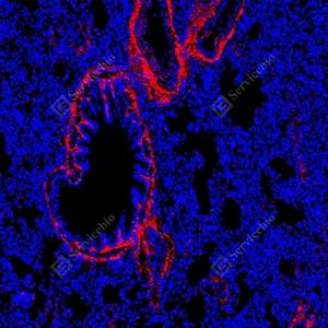 16 GB155707_Collagen I_red_D01757_D0175725090201 d500 M lung_10.0x_IF_WM.jpg