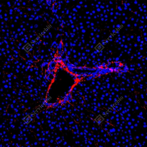 17 GB155707_Collagen I_red_D01757_D0175725090201 d500 R liver_20.0x_IF_WM.jpg