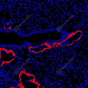 18 GB155707_Collagen I_red_D01757_D0175725090201 d500 R lung_10.0x_IF_WM.jpg