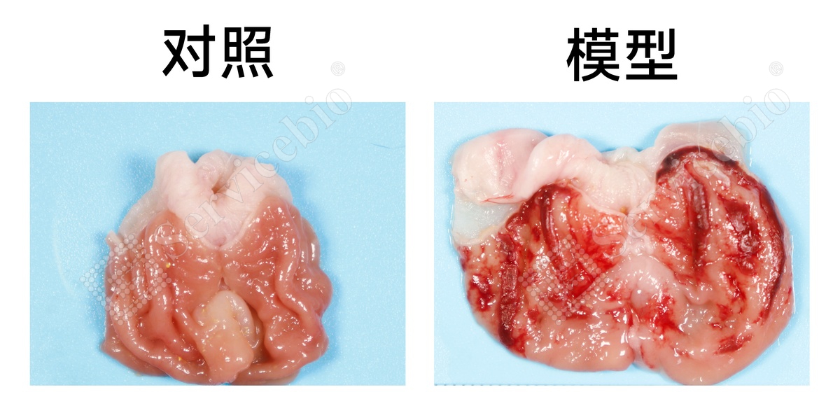 1、胃大体拍照.jpg