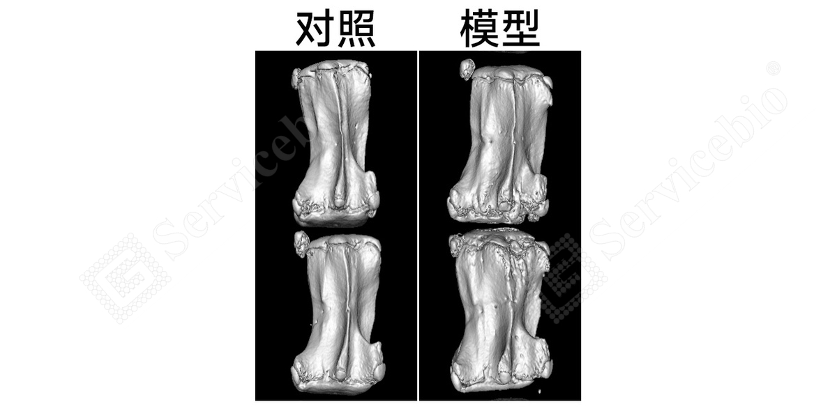 1、椎间盘Micro-YT.jpg