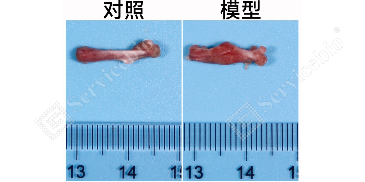 1、股骨大体.jpg