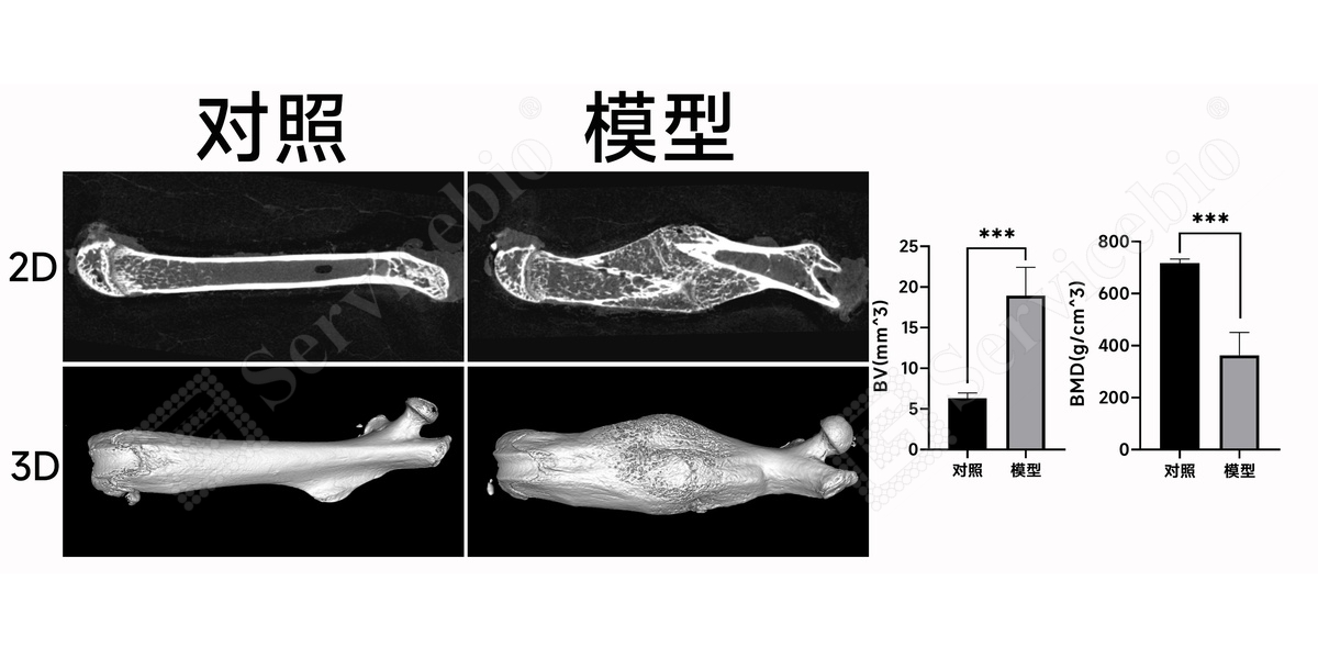 2、股骨Micro-YT.jpg