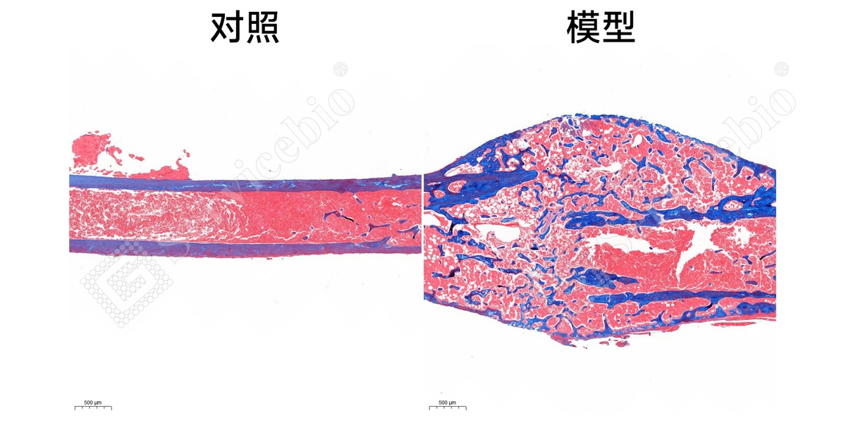 4、股骨Masson染色.jpg