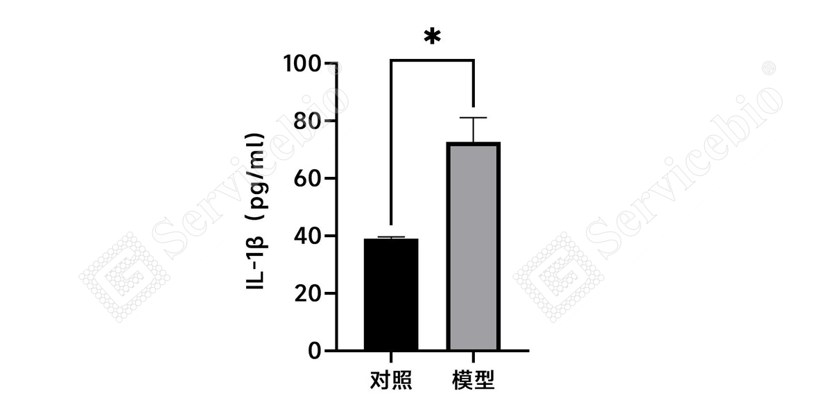 3、血清Elisa（IL-1）.jpg
