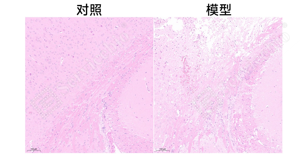 2、脑HE染色.jpg
