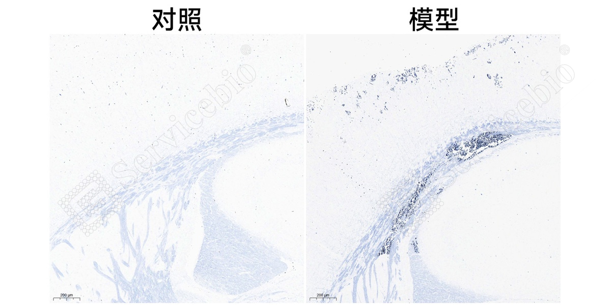 4、脑LoyeZ染色.jpg