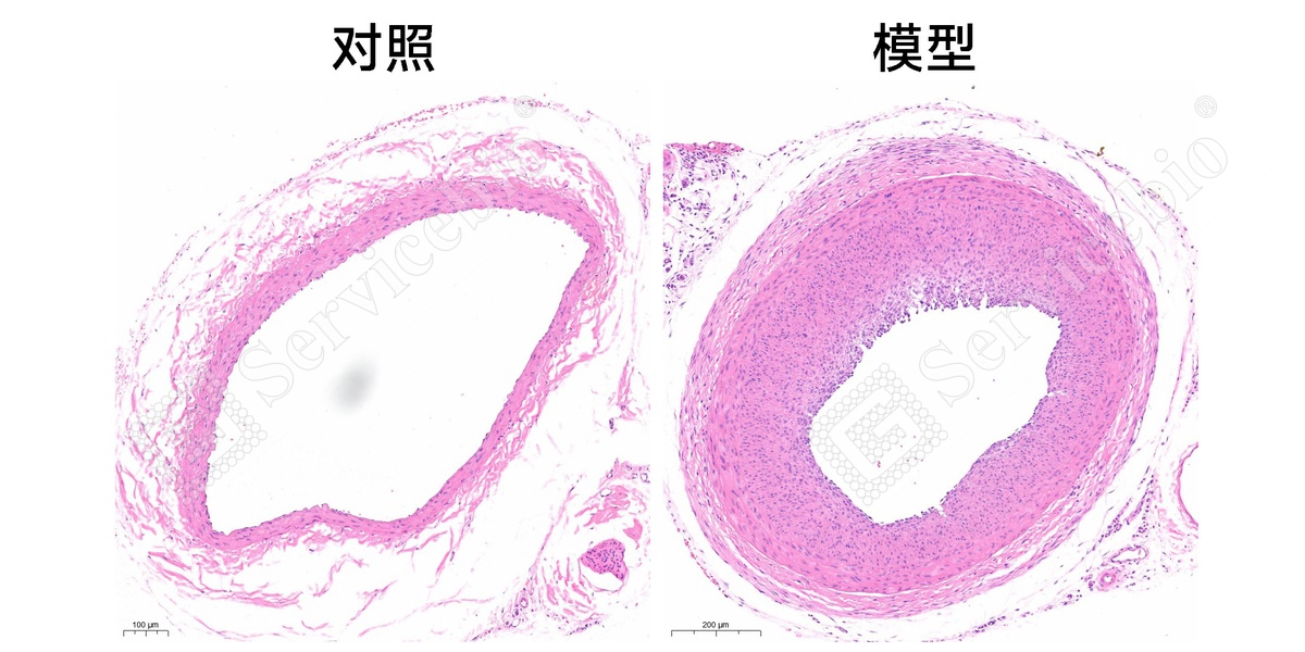 1、血管HE染色.jpg