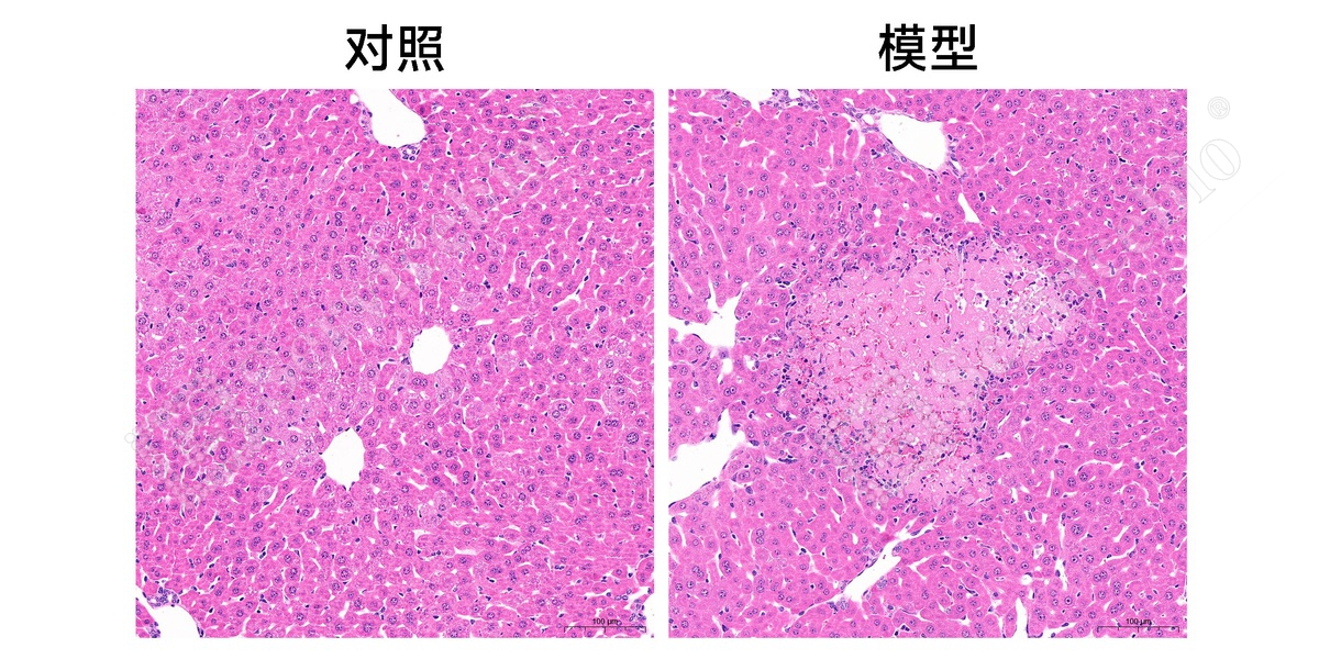 2、肝脏HE染色.jpg