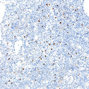5 GB15188 20250126_TNF_mAb20325052002_d200 M Inflammatory model induced by lps+BFA(6h) lung_20.0x_IHC_WM.jpg