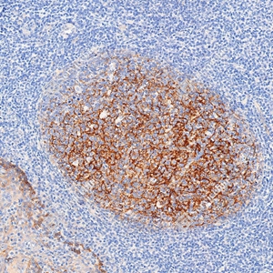 01 GB112007 20260128_CD35_727620062302 d1000 H tonsil_20x_IHC_WM.jpg