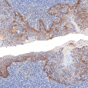 02 GB112007 20260128_CD35_727620062302 d1000 H tonsil_21x_IHC_WM.jpg