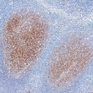 03 GB112007 20260128_CD35_727620062302 d1000 H tonsil_12x_IHC_WM.jpg