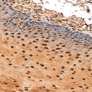 2 GB155700 20260106_Ubiquitin_D01999_D0199925111901 _d1500 _H esophagus_30.0x_IHC_WM.jpg