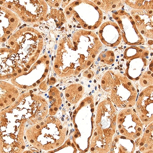 3 GB155700 20260106_Ubiquitin_D01999_D0199925111901 _d1500 _H kidney_30.0x_IHC_WM.jpg
