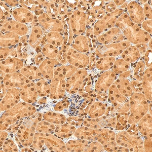 5 GB155700 20260106_Ubiquitin_D01999_D0199925111901 _d1500 _M kidney_30.0x_IHC_WM.jpg