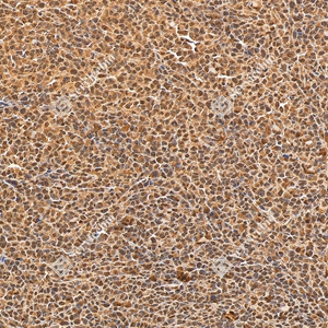 6 GB155700 20260106_Ubiquitin_D01999_D0199925111901 _d1500_ M subcutaneous nude-mouse model of 4T1 cell_20.0x_IHC_WM.jpg