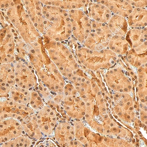 7 GB155700 20260106_Ubiquitin_D01999_D0199925111901 _d1500_ R kidney_30.0x_IHC_WM.jpg