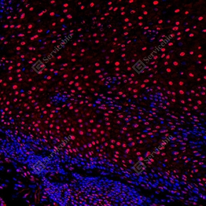 8 GB155700 20260106_Ubiquitin_red_D01999_D0199925111901_ d1500_ H esophagus_20.0x_IF_WM.jpg