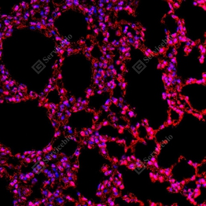 9 GB155700 20260106_Ubiquitin_red_D01999_D0199925111901_ d1500_ M lung_30.0x_IF_WM.jpg