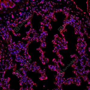 10 GB155700 20260106_Ubiquitin_red_D01999_D0199925111901 _d1500_ R lung_20.0x_IF_WM.jpg