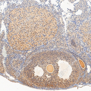 08 GB11275-1 20260120_FSHR_28117011302 d300 M ovary_20x_IHC_WM_副本 - 副本.jpg