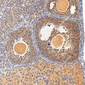 09 GB11275-1 20260120_FSHR_28117011302 d300 M ovary_34x_IHC_WM_副本 - 副本.jpg