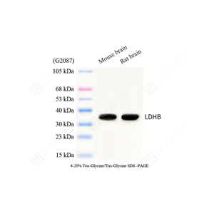 01WB2 GB15342_LDHB_mAb27125062402_d1000_WB.jpg