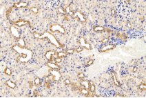 1530242801713854.png blob.png