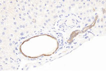 1530242820864078.png blob.png