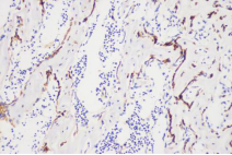 1530065088283235.png blob.png