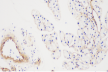 1530065107975100.png blob.png