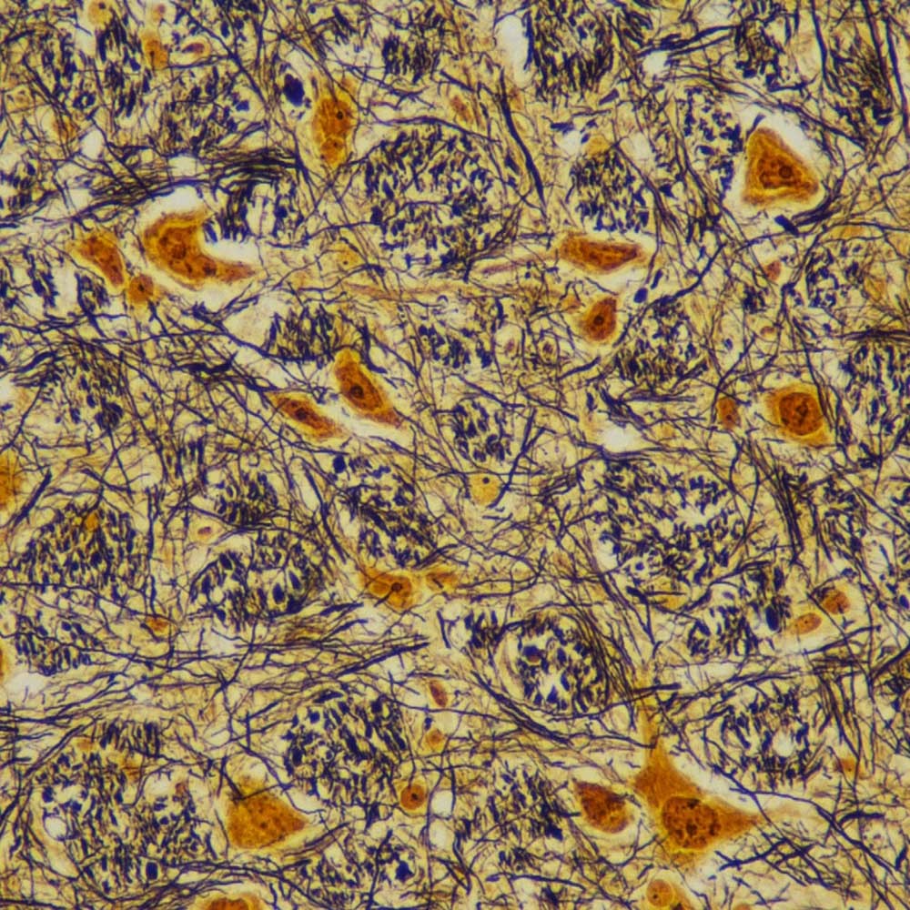 甘氨酸银染色试剂盒